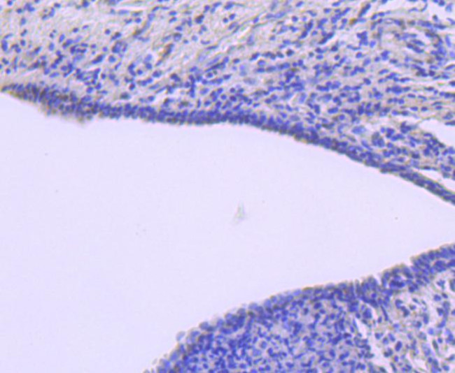 ATF1 Antibody in Immunohistochemistry (Paraffin) (IHC (P))