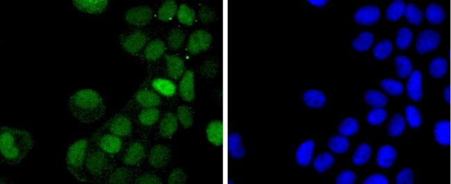 Phospho-c-Jun (Thr91) Antibody in Immunocytochemistry (ICC/IF)