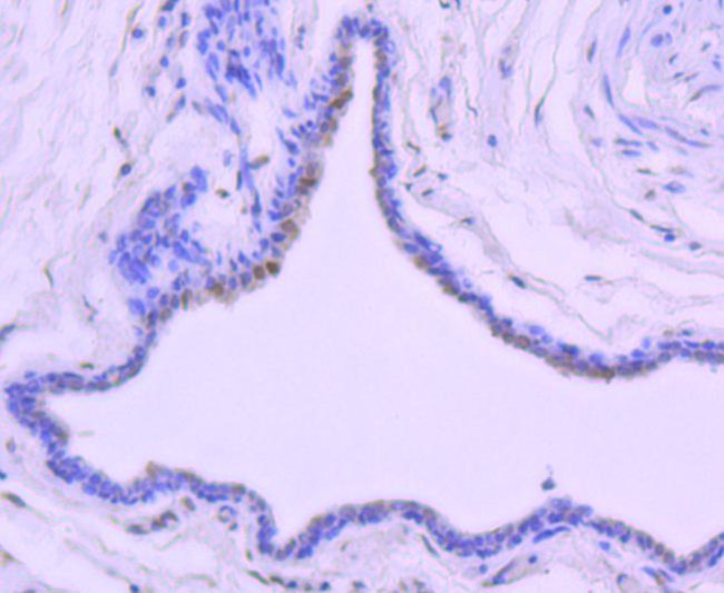 Phospho-c-Jun (Thr91) Antibody in Immunohistochemistry (Paraffin) (IHC (P))