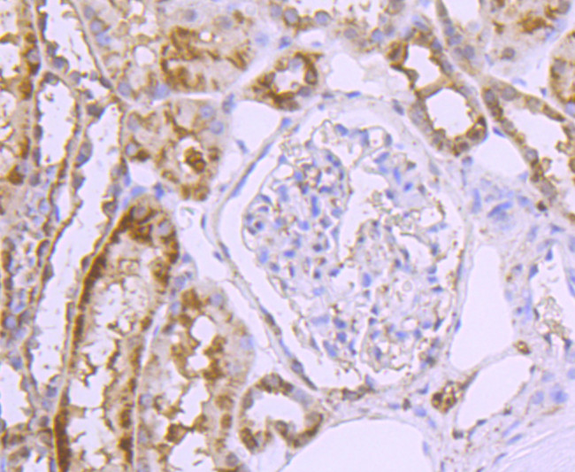 GLUT2 Antibody in Immunohistochemistry (Paraffin) (IHC (P))