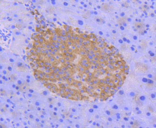 Phospho-AMPK alpha-2 (Ser345) Antibody in Immunohistochemistry (Paraffin) (IHC (P))