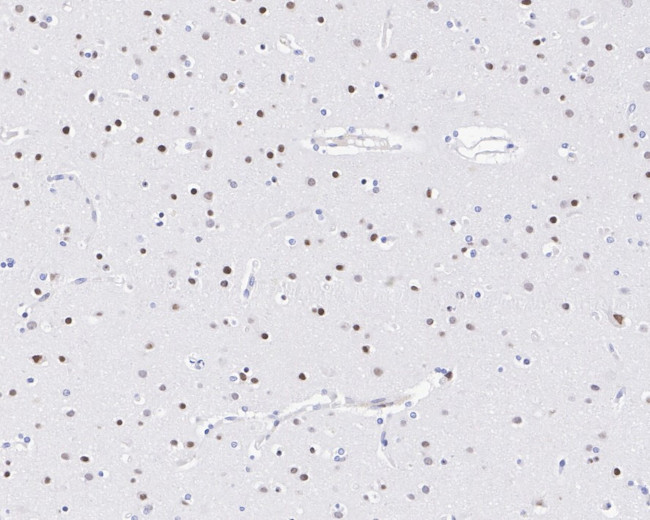 SOX1 Antibody in Immunohistochemistry (Paraffin) (IHC (P))