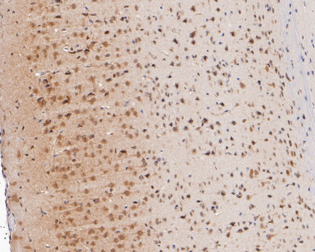 SOX1 Antibody in Immunohistochemistry (Paraffin) (IHC (P))