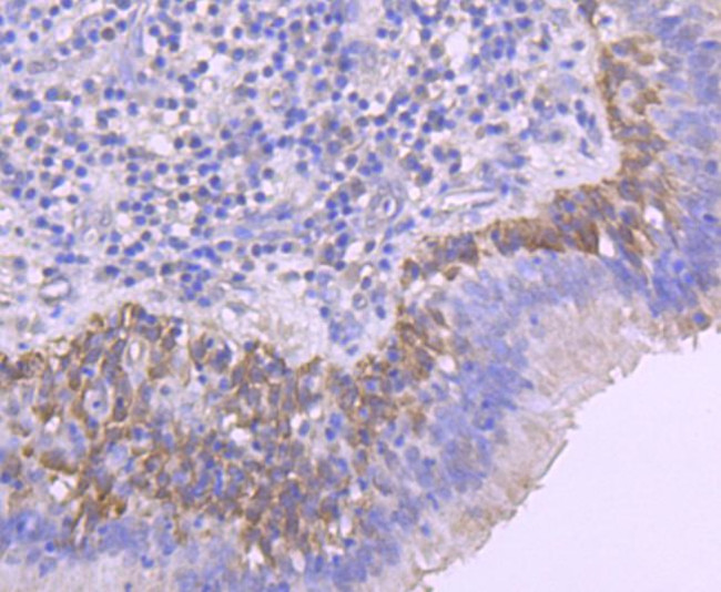 Phospho-RAC1/CDC42 (Ser71) Antibody in Immunohistochemistry (Paraffin) (IHC (P))