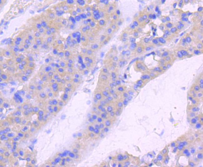 Phospho-RAC1/CDC42 (Ser71) Antibody in Immunohistochemistry (Paraffin) (IHC (P))