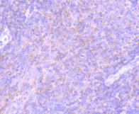 PD-L1 (CD274) Antibody in Immunohistochemistry (Paraffin) (IHC (P))