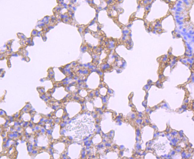 PD-L1 (CD274) Antibody in Immunohistochemistry (Paraffin) (IHC (P))