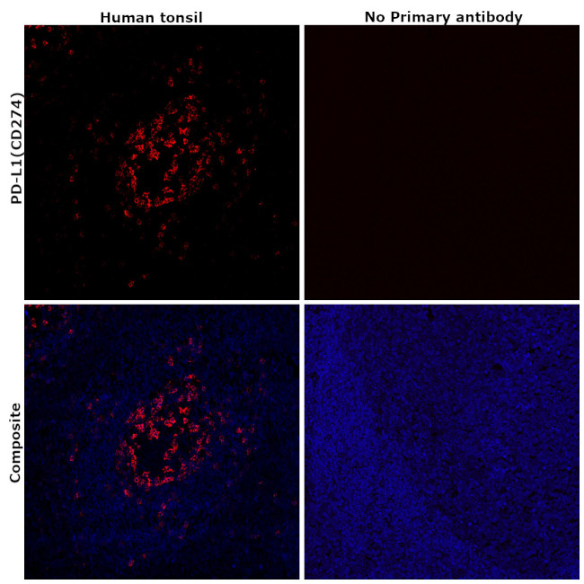 PD-L1 (CD274) Antibody in Immunohistochemistry (Paraffin) (IHC (P))