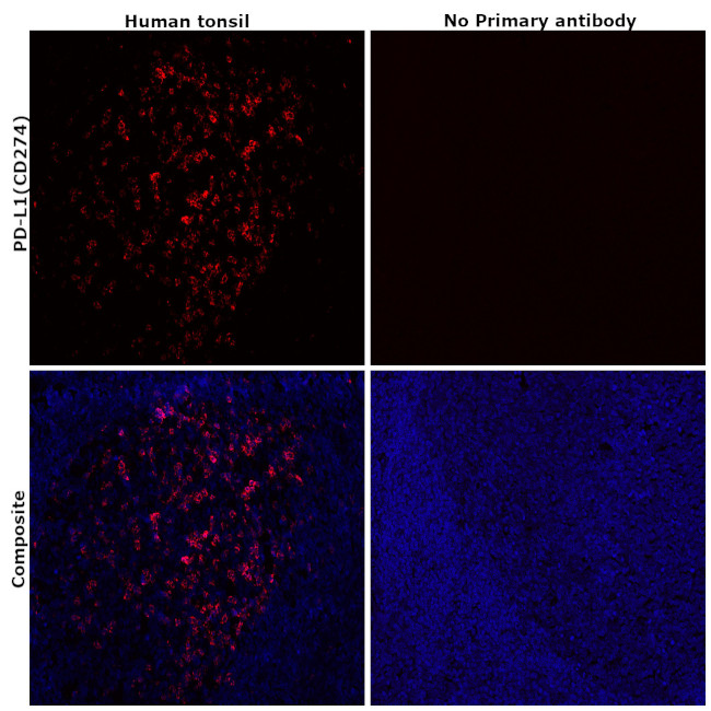 PD-L1 (CD274) Antibody in Immunohistochemistry (Paraffin) (IHC (P))