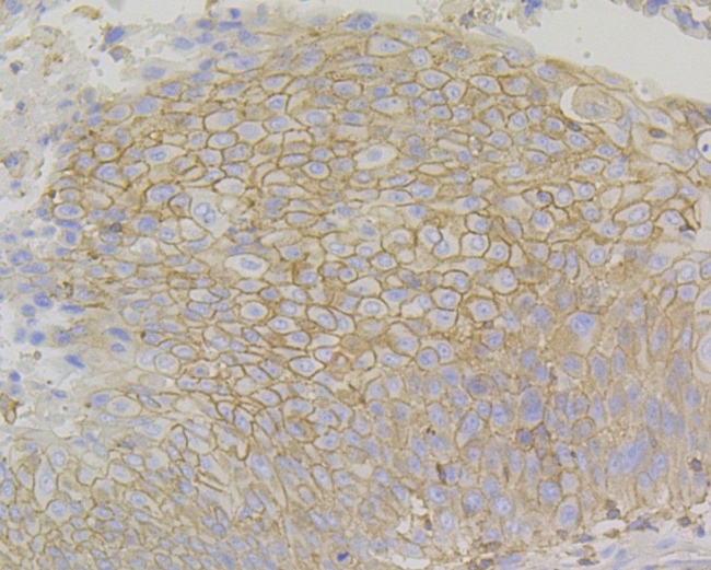 PD-L1 (CD274) Antibody in Immunohistochemistry (Paraffin) (IHC (P))