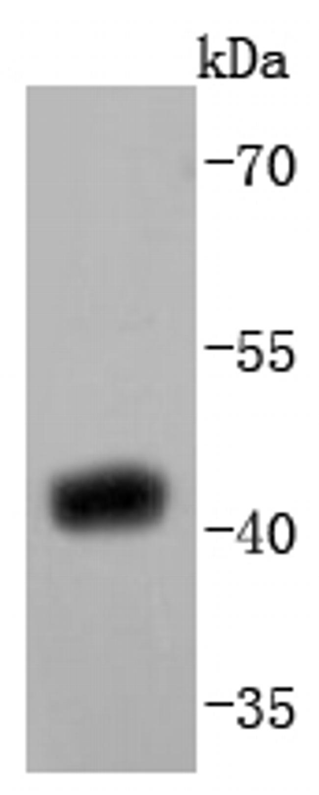 SIRT2 Antibody in Western Blot (WB)