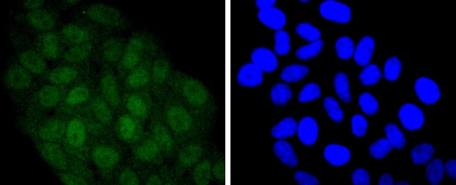 STAT5 alpha/beta Antibody in Immunocytochemistry (ICC/IF)