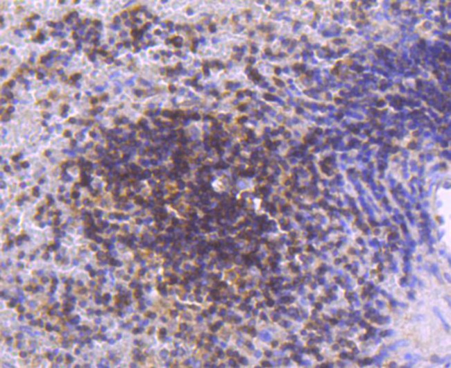 STAT5 alpha/beta Antibody in Immunohistochemistry (Paraffin) (IHC (P))