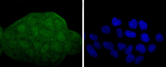 MEK3/MEK6 Antibody in Immunocytochemistry (ICC/IF)