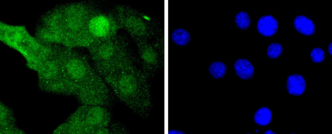 MEK3/MEK6 Antibody in Immunocytochemistry (ICC/IF)