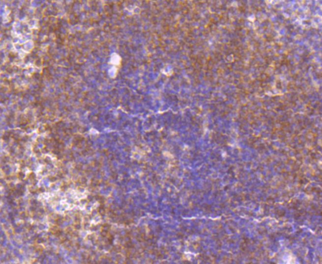 MEK3/MEK6 Antibody in Immunohistochemistry (Paraffin) (IHC (P))