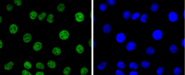 PAX8 Antibody in Immunocytochemistry (ICC/IF)