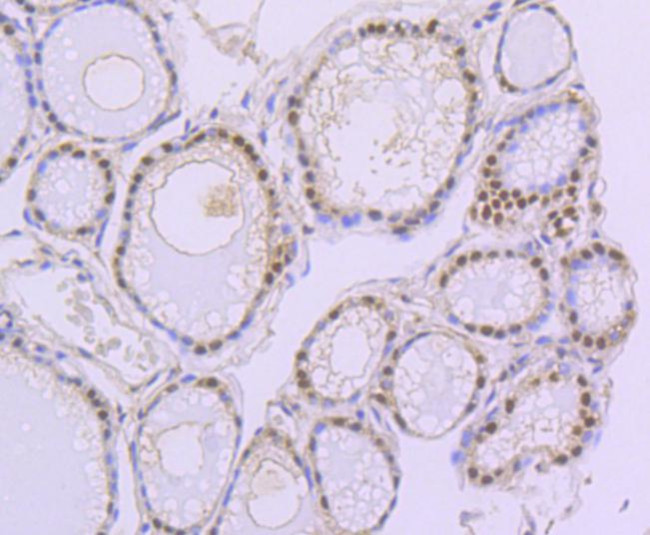 PAX8 Antibody in Immunohistochemistry (Paraffin) (IHC (P))