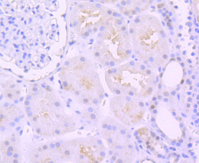 PAX8 Antibody in Immunohistochemistry (Paraffin) (IHC (P))