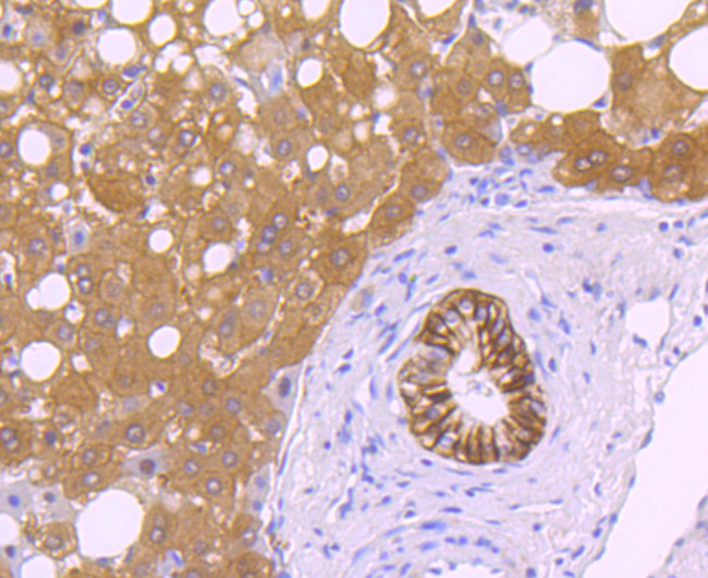 Carbonic Anhydrase IX Antibody in Immunohistochemistry (Paraffin) (IHC (P))