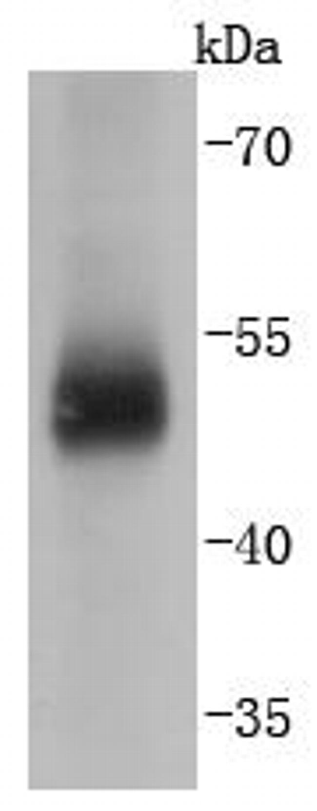 Carbonic Anhydrase IX Antibody in Western Blot (WB)