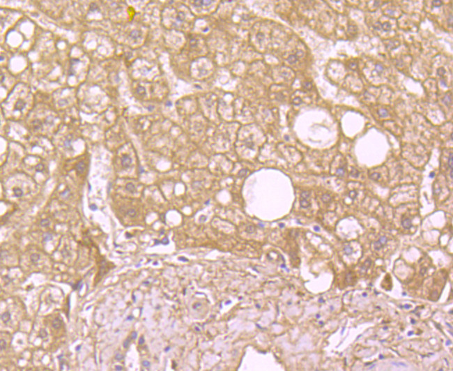 SOD2 (MnSOD) Antibody in Immunohistochemistry (Paraffin) (IHC (P))