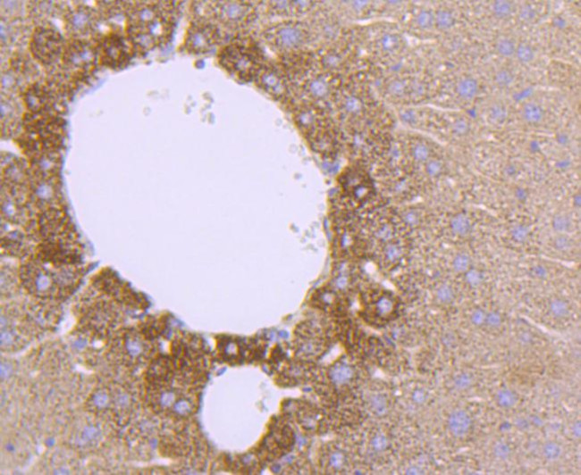 SOD2 (MnSOD) Antibody in Immunohistochemistry (Paraffin) (IHC (P))