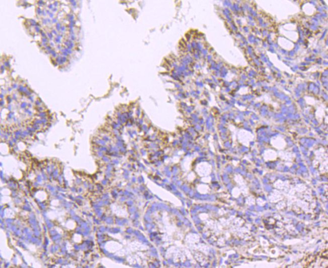 SOD2 (MnSOD) Antibody in Immunohistochemistry (Paraffin) (IHC (P))