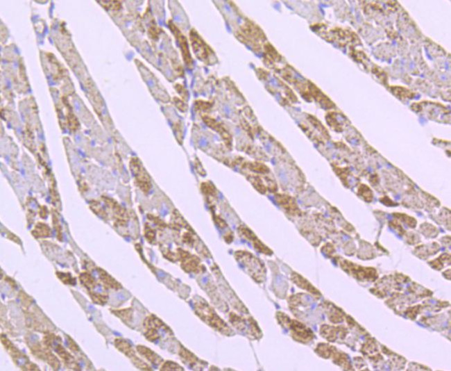 SOD2 (MnSOD) Antibody in Immunohistochemistry (Paraffin) (IHC (P))