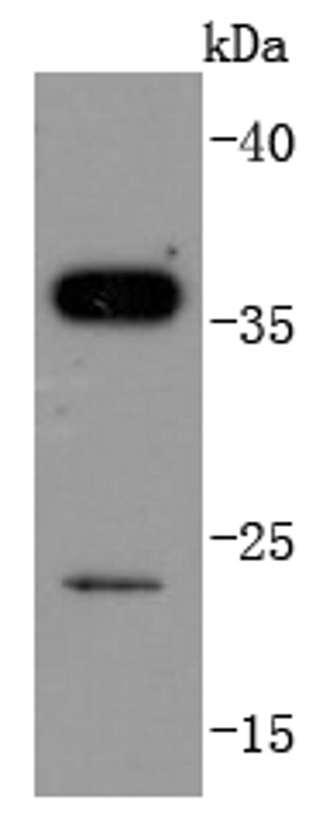 SIRT5 Antibody in Western Blot (WB)