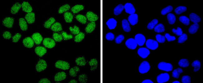 ARID1A Antibody in Immunocytochemistry (ICC/IF)