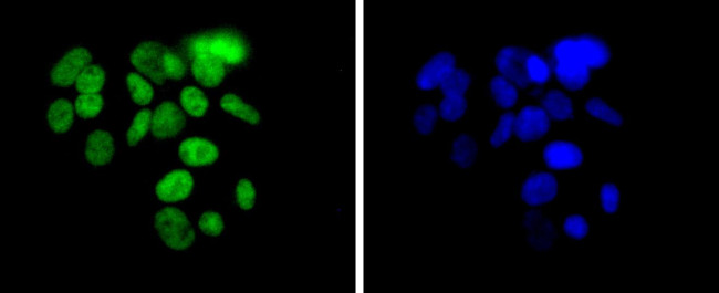 ARID1A Antibody in Immunocytochemistry (ICC/IF)