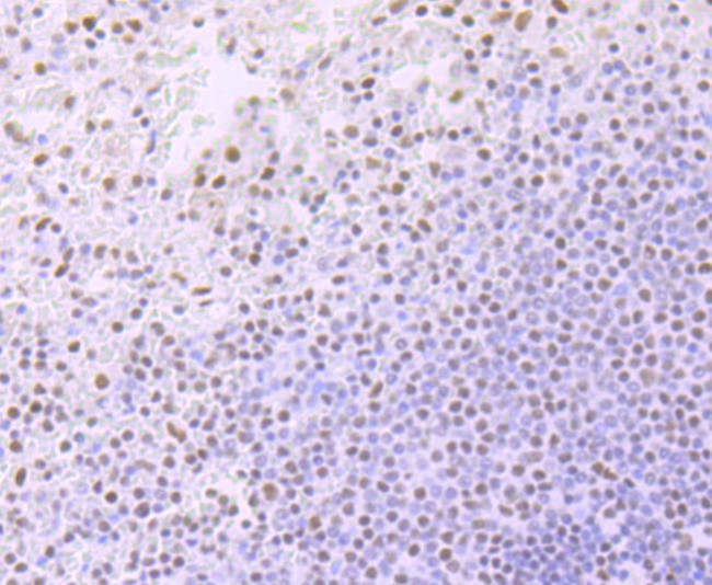 ARID1A Antibody in Immunohistochemistry (Paraffin) (IHC (P))