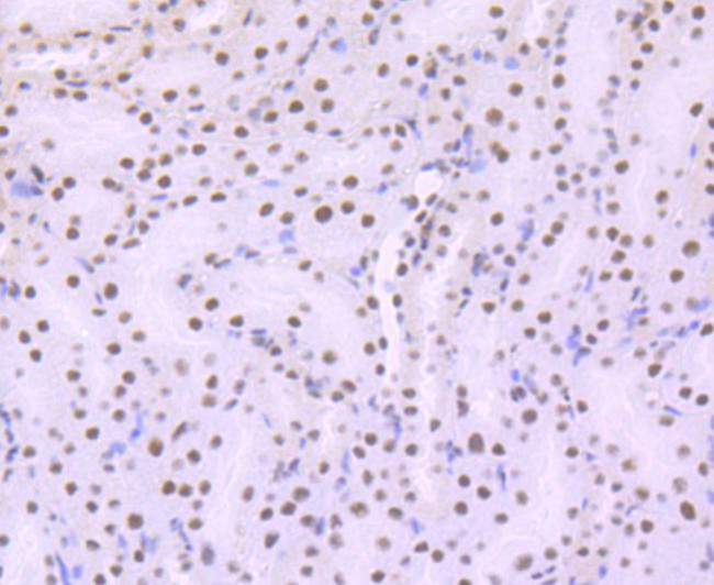 ARID1A Antibody in Immunohistochemistry (Paraffin) (IHC (P))