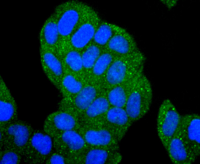 HDAC6 Antibody in Immunocytochemistry (ICC/IF)