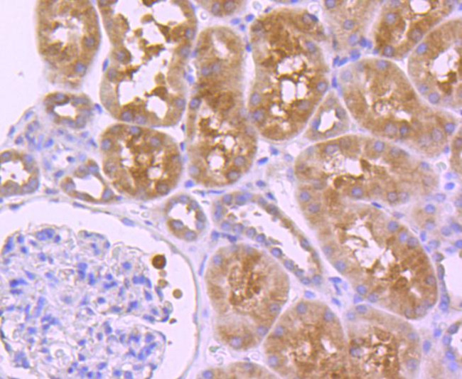 HDAC6 Antibody in Immunohistochemistry (Paraffin) (IHC (P))