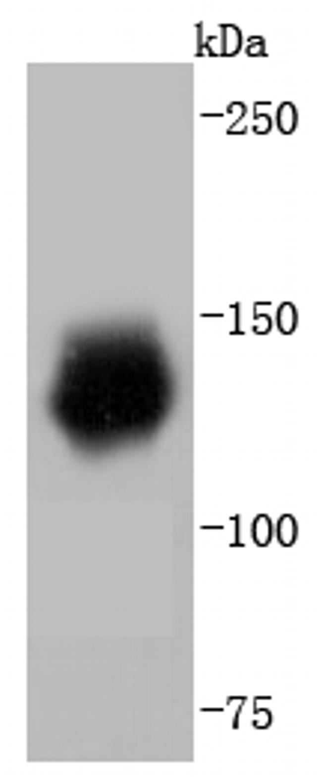 HDAC6 Antibody in Western Blot (WB)