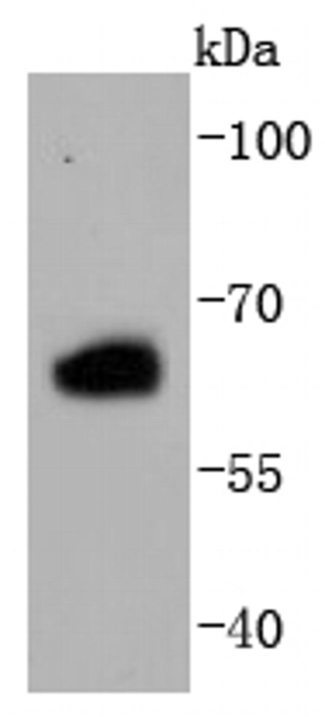 Estrogen Receptor beta Antibody in Western Blot (WB)