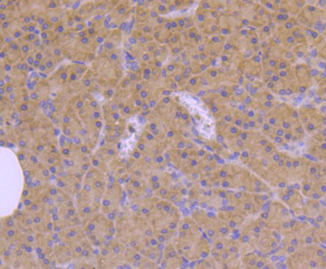 Cdc42 Antibody in Immunohistochemistry (Paraffin) (IHC (P))