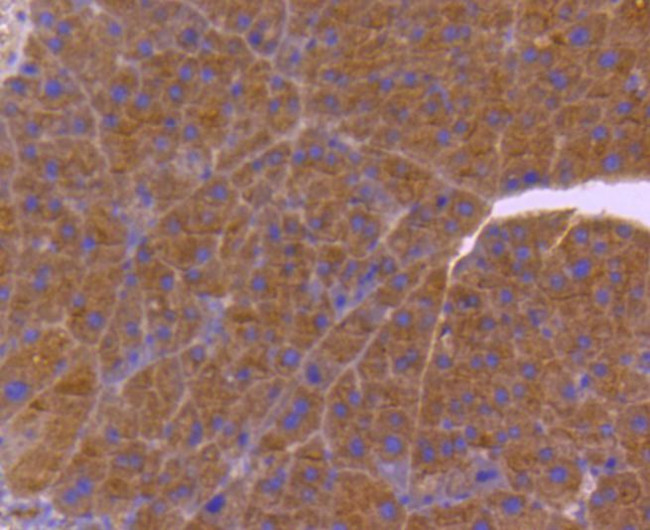 Cdc42 Antibody in Immunohistochemistry (Paraffin) (IHC (P))