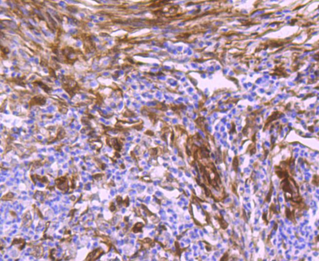 HSP27 Antibody in Immunohistochemistry (Paraffin) (IHC (P))