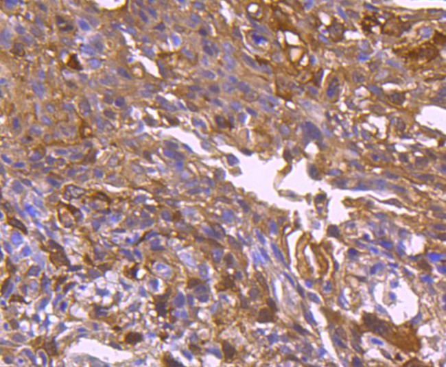 HSP27 Antibody in Immunohistochemistry (Paraffin) (IHC (P))