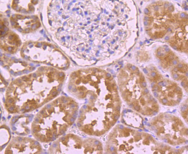 Cdc45L Antibody in Immunohistochemistry (Paraffin) (IHC (P))