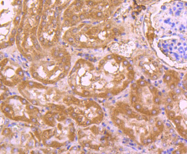 Cdc45L Antibody in Immunohistochemistry (Paraffin) (IHC (P))