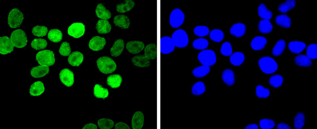 E2F1 Antibody in Immunocytochemistry (ICC/IF)