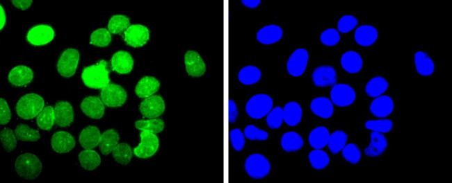 E2F1 Antibody in Immunocytochemistry (ICC/IF)