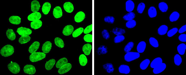 E2F1 Antibody in Immunocytochemistry (ICC/IF)