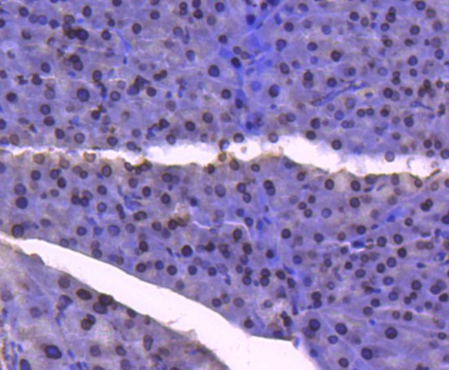 E2F1 Antibody in Immunohistochemistry (Paraffin) (IHC (P))