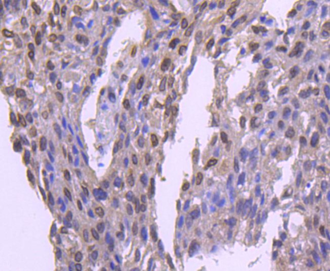E2F1 Antibody in Immunohistochemistry (Paraffin) (IHC (P))