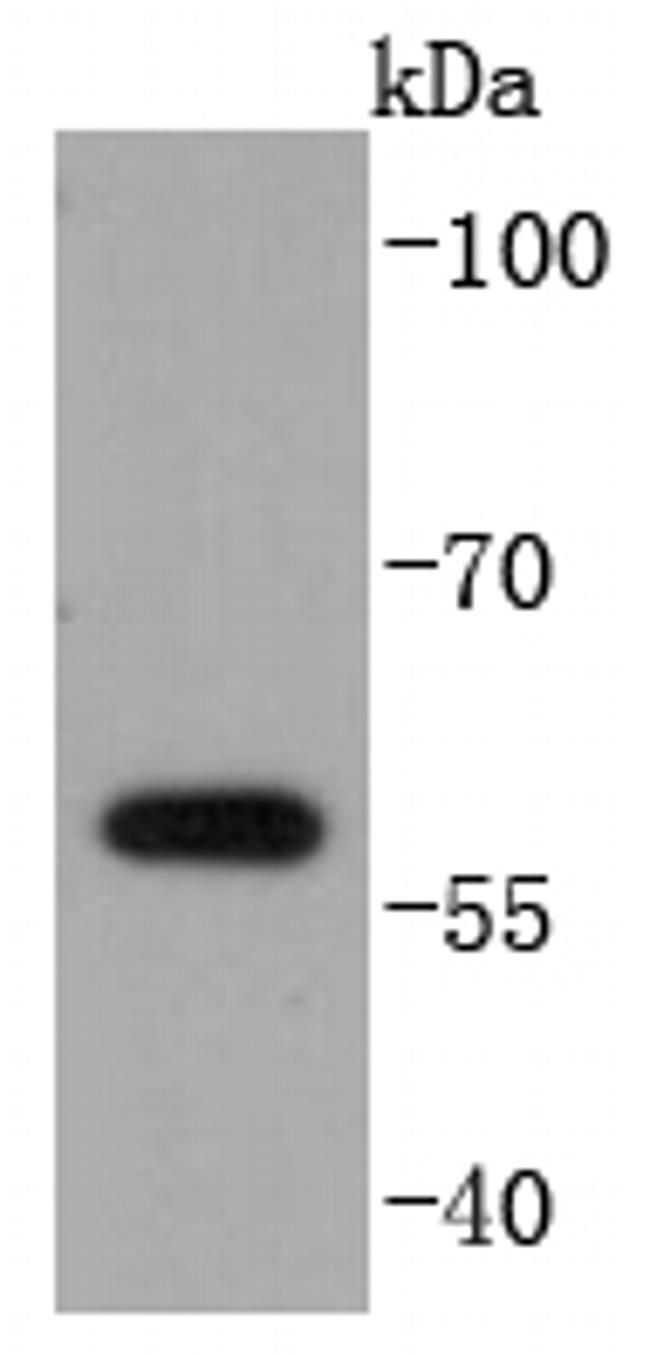 E2F1 Antibody in Western Blot (WB)